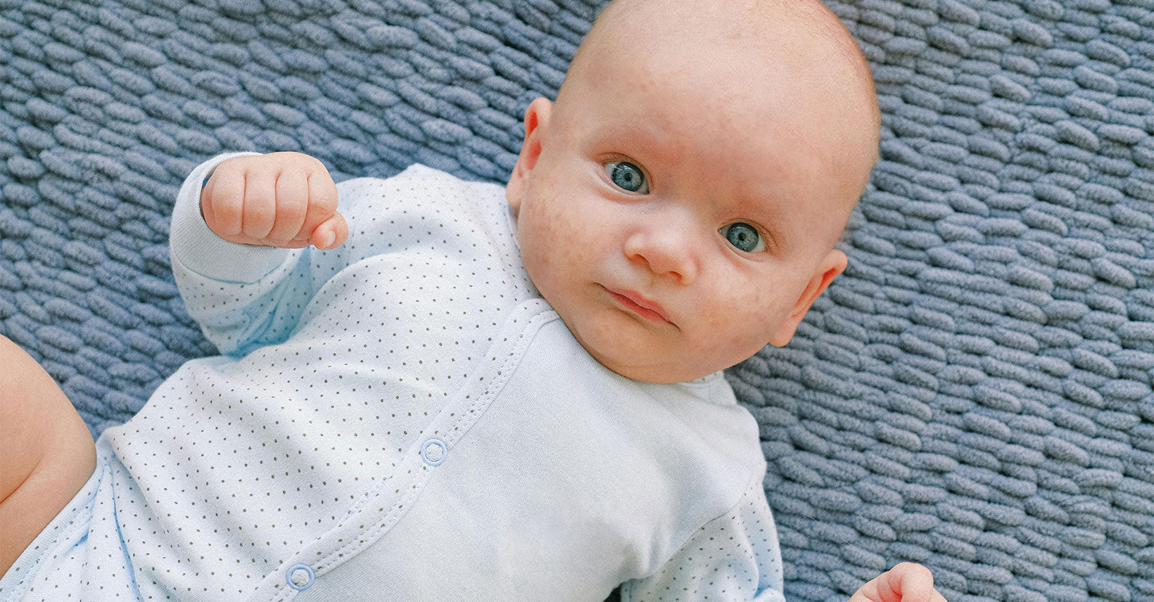 How To Get Rid Of Baby Acne?